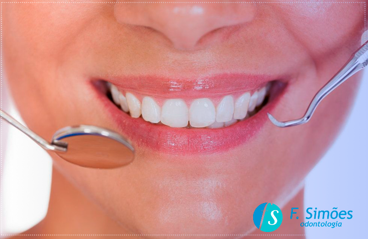 Benefícios de um implante dentário