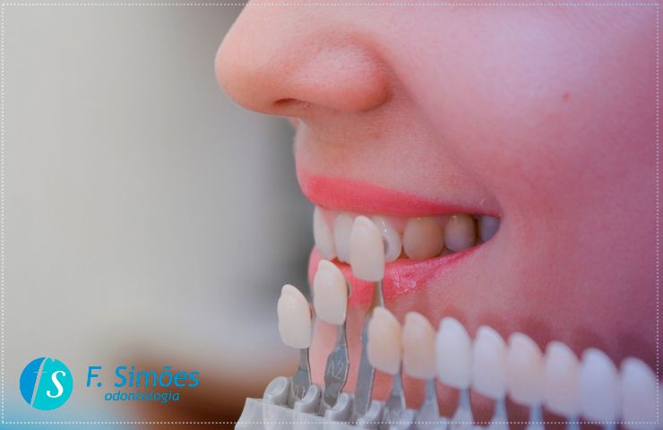 Confira os benefícios da estética dental para mulheres