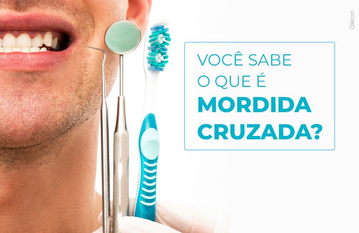 Você sabe o que é mordida cruzada? 