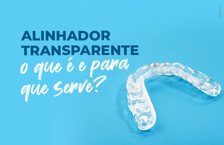 Alinhador transparente: o que é e para que serve?