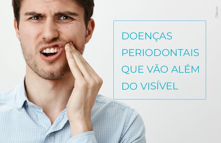 Dente amolecido: doenças periodontais que vão além do visível
