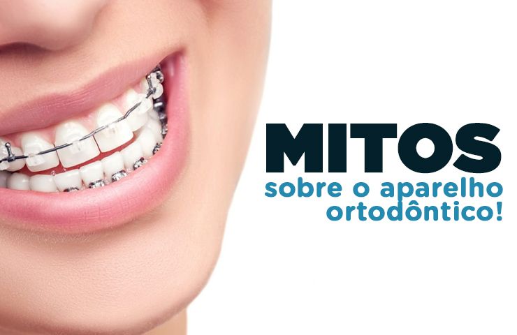 Mitos sobre o aparelho ortodôntico!