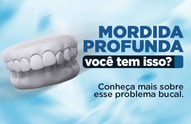 Mordida profunda: você tem isso? Conheça mais sobre esse problema bucal. 