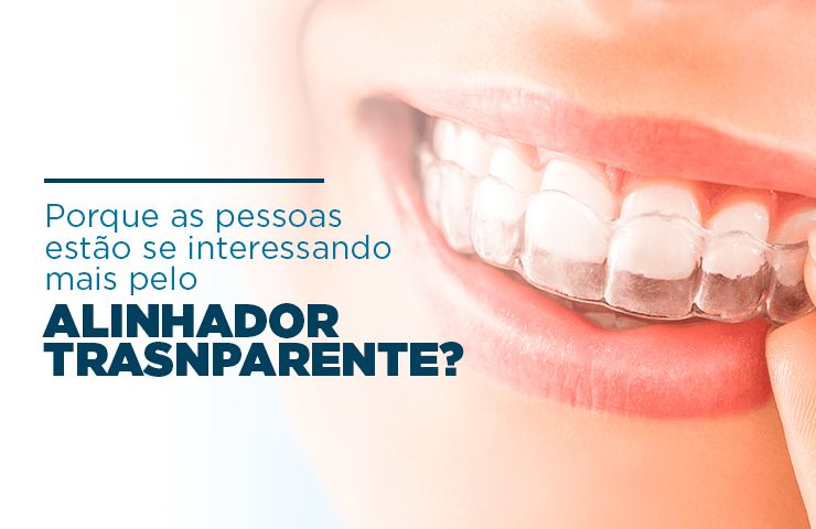 Porque as pessoas estão se interessando mais pelo alinhador transparente?