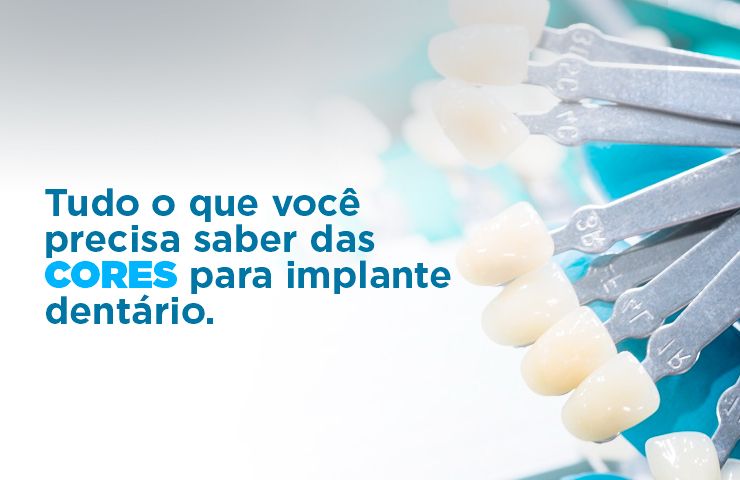 Tudo o que você precisa saber das cores para implante dentário