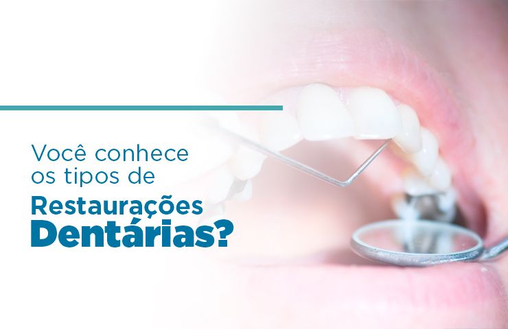 Você conhece os tipos de Restaurações Dentárias?