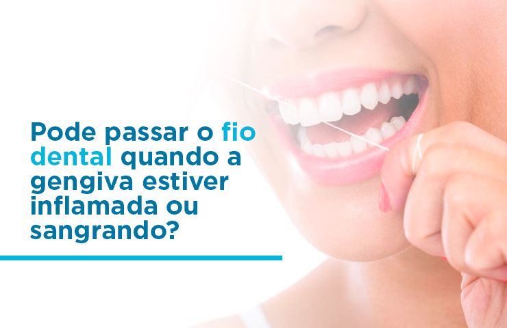 Pode passar o fio dental quando a gengiva estiver inflamada ou sangrando?