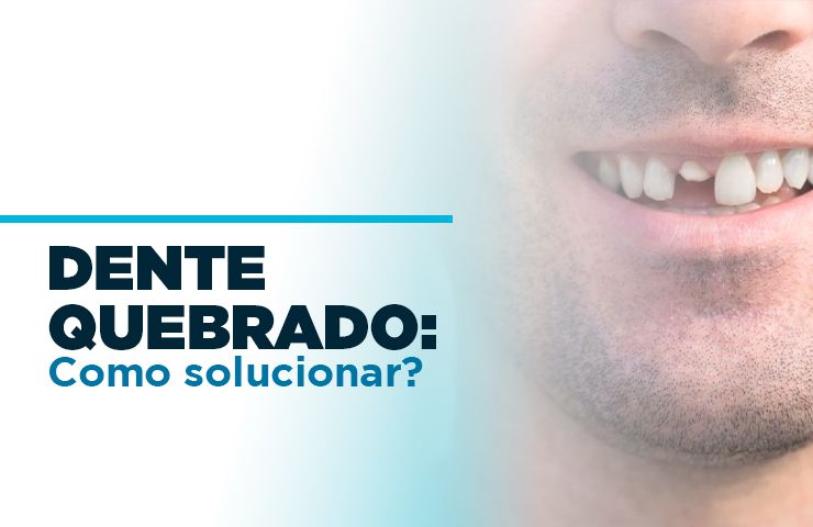 Dente quebrado: Como solucionar 