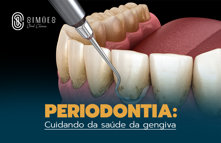 Periodontia: Cuidando da saúde da gengiva